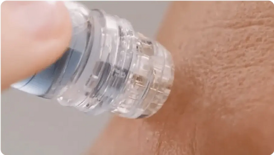 Micro infusion : guide complet pour une peau éclatante et jeune sereniGlow