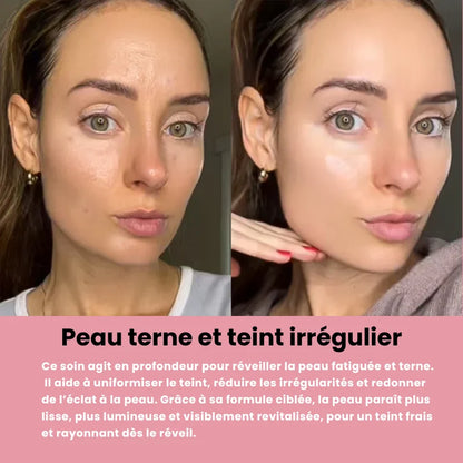 Système de micro infusion sereniGlow