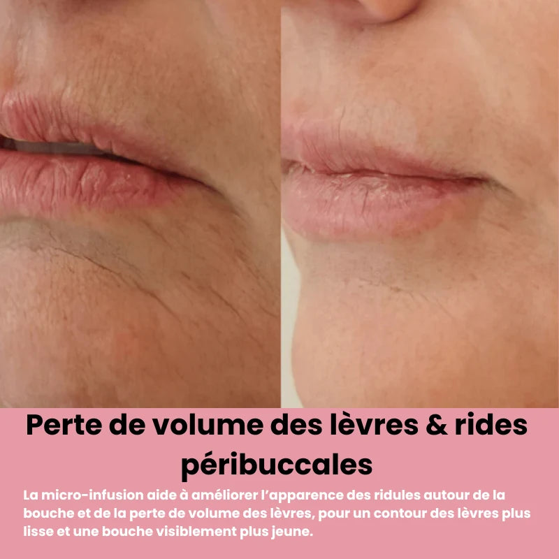 Système de micro infusion sereniGlow