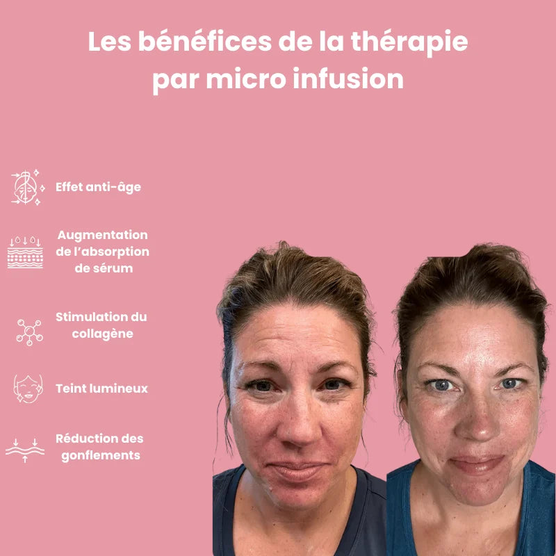 Système de micro infusion sereniGlow