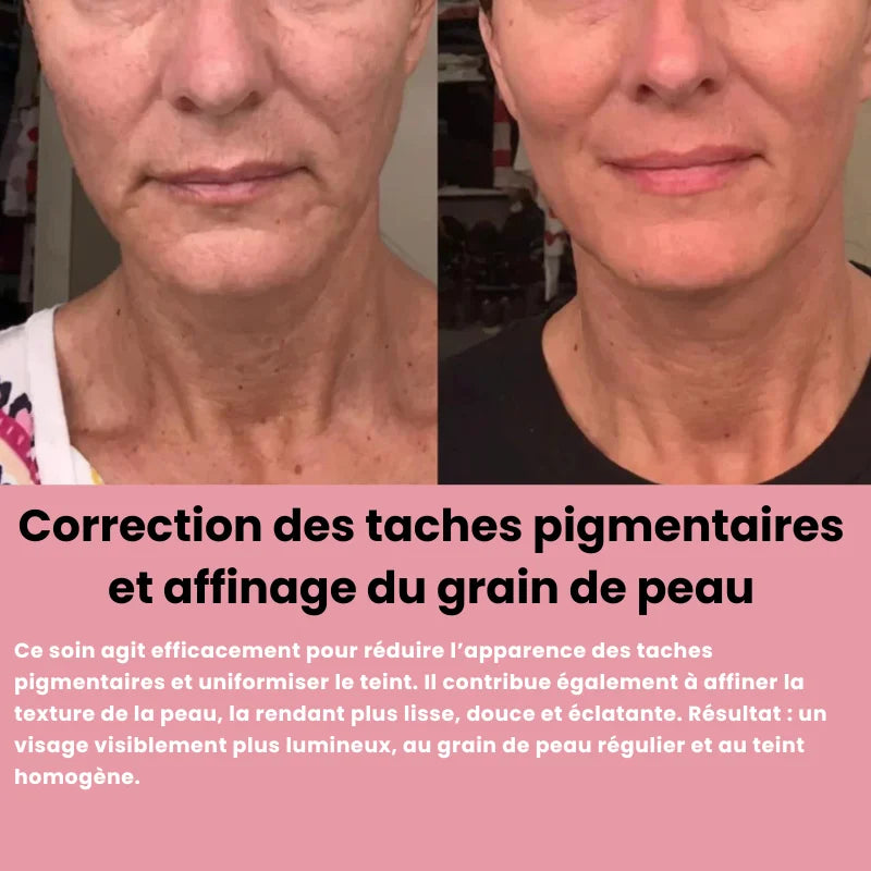 Système de micro infusion sereniGlow