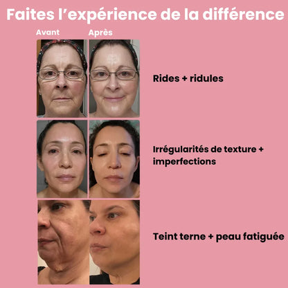 Système de micro infusion sereniGlow