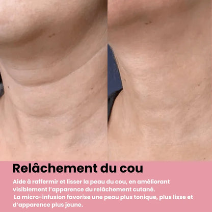 Système de micro infusion sereniGlow